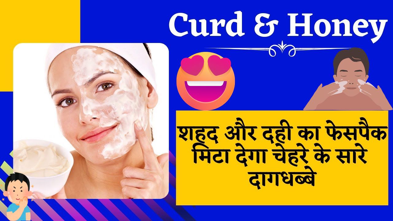 curd and honey home remedy